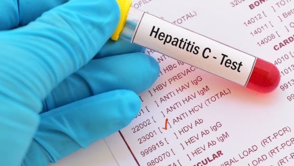 Testing for hepatitis C