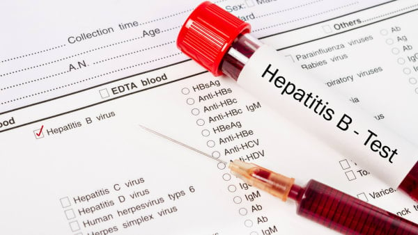 Testing for hepatitis B
